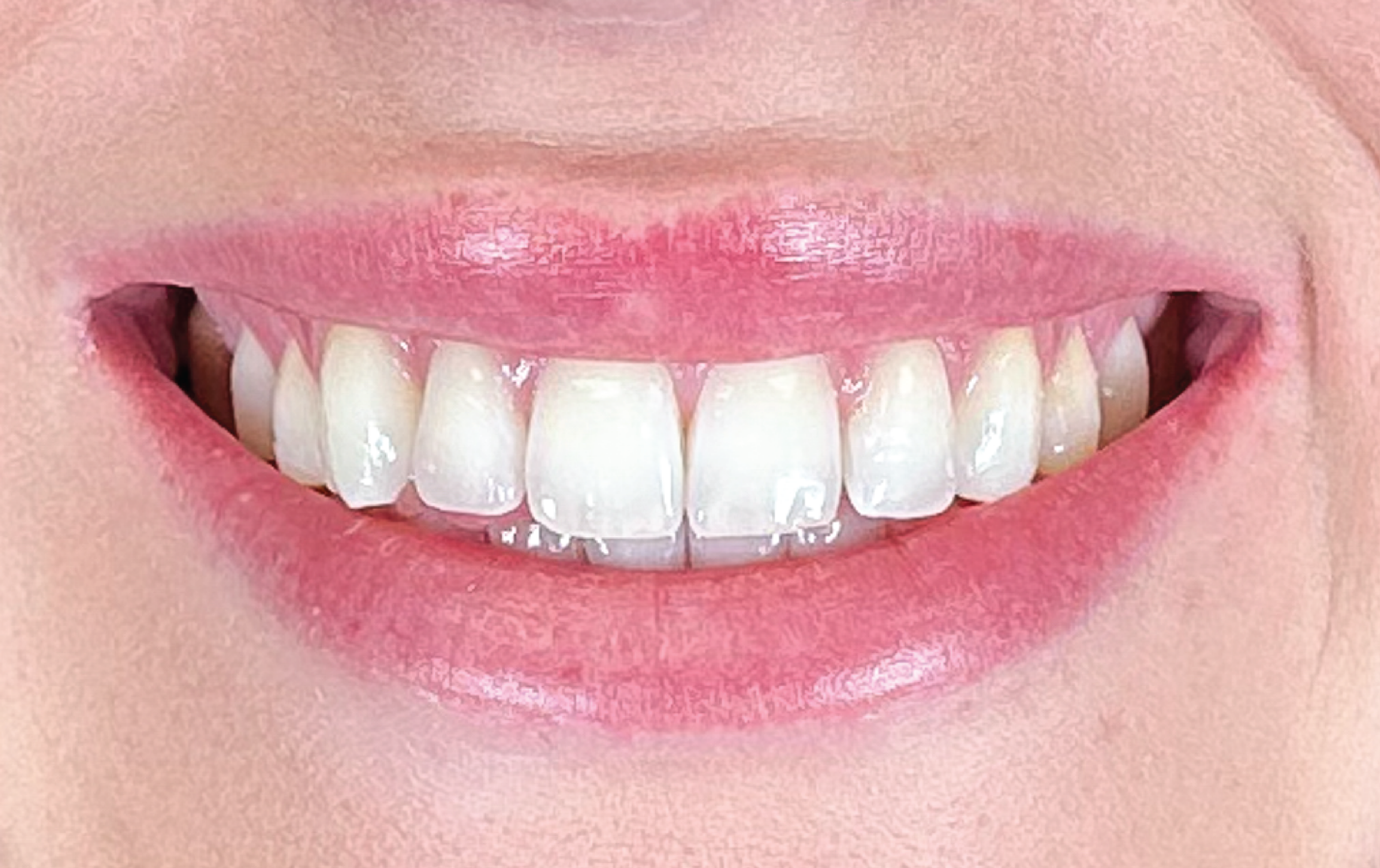 B&A2--14